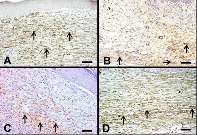 Figure 4.  Effects of different physical training intensities on the distribution of myofibroblasts in the granulation tissue 14  days after wounding