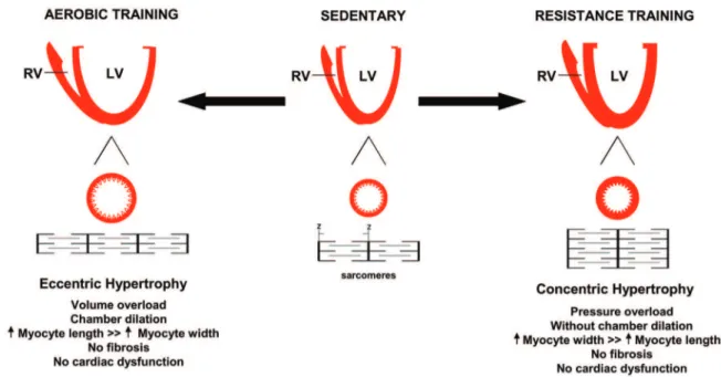 Figure 1.  Effect of exercise training on cardiac hypertrophy. Physiological hypertrophy is characterized by a uniform profile of  ventricular wall and septum growth, without fibrosis and cardiac dysfunction