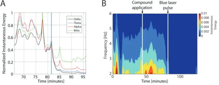 Figure 1B shows the wavelet spectrogram for mouse  1, which was the best case. The first vertical line indicates  the moment of RuBiGABA-PMe 3  application and the  sec-ond line indicates the time when the laser stimulus was  flashed