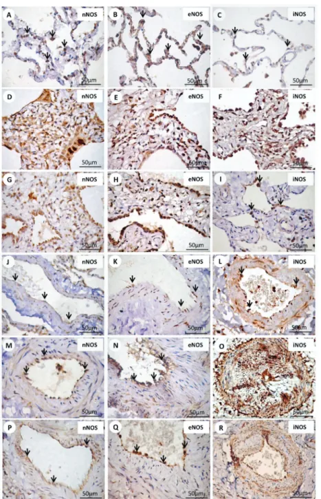 Figure 1. Immunohistochemical staining with nNOS, eNOS and iNOS. Cell expressions of nNOS, eNOS and iNOS in septal interstitium and intrapulmonary vessels from normal and systemic sclerosis (SSc) lung tissue are shown