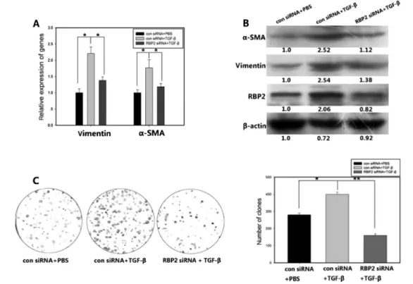 Figure 3. The activation of LX-2 cells by TGF-b was attenuated by RBP2 suppression. Quantification (A) and Western blot analysis (B) of a-SMA and vimentin after treatment with RBP2 siRNA and TGF-b (5 ng/mL)