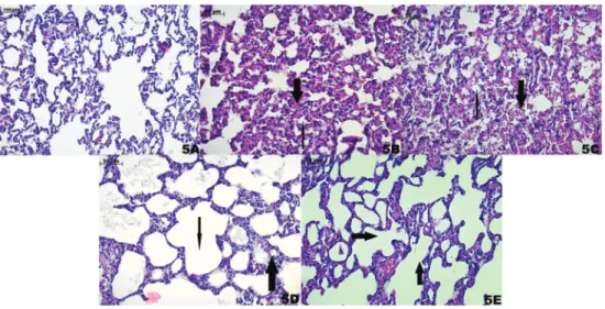 Figure 5. Histopathological findings of the groups. A, Normal lung parenchyma in the control group [hematoxylin-eosin (HE), 100X]
