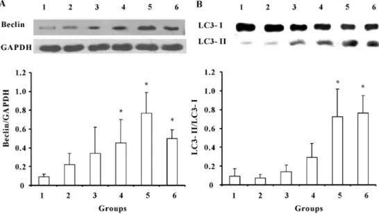 Figure 2. Ischemic preconditioning (IPC) activates autophagy in rats undergoing ischemic reperfusion (I/R) 24 h post-ischemic injury.