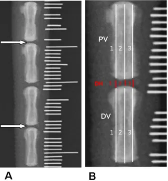 Figure 2. Radiographic assessment of intervertebral disc degeneration. A, Radiographic images were taken using a radiopaque scale with millimeter markings to recognize the intervertebral disc level of interest