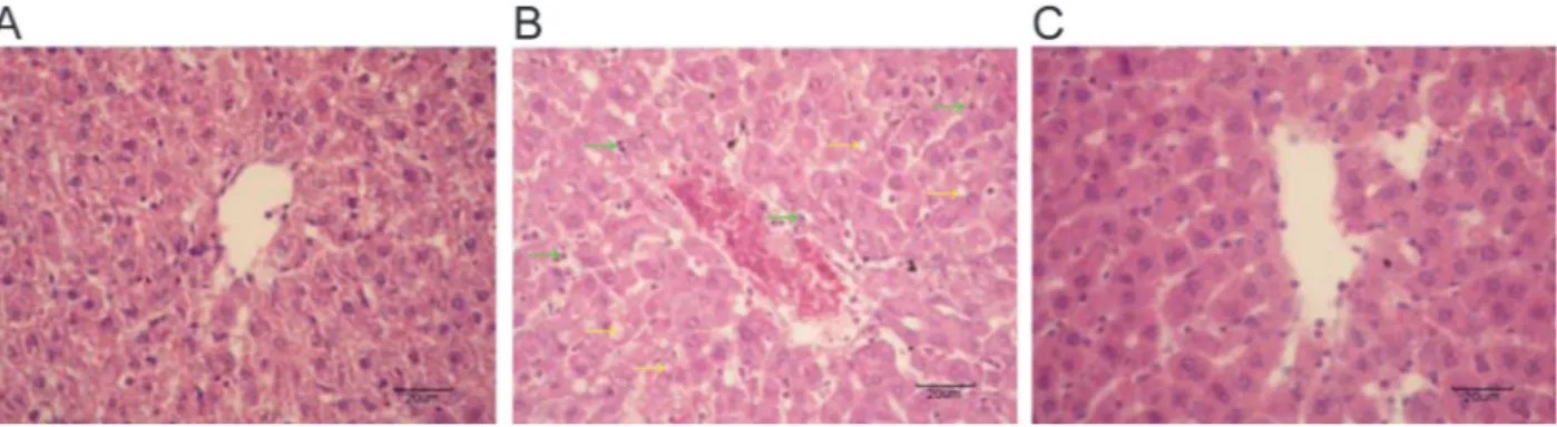 Figure 1. Effect of exogenous normal lymph (ENL) on hepatic morphology in rats (HE staining, 400 6 , magnification bar: 20 mm).