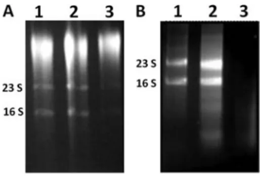 Figure 1. RNA that was obtained from the methicillin-resistant S. aureus (MRSA) isolate BMB9393, which was grown in the logarithmic (A) or stationary (B) phase using mechanical (lane 1), enzymatic (lane 2), and sheared whole-cell lyses (lane 3).