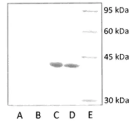 Figure 2. Coomassie brilliant blue stained SDS-PAGE result showing the protein content of crude extracts from samples.