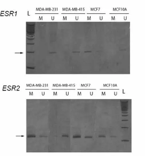 Figura 4. Análise de MSP dos genes ESR1B e ESR2 em amostras de DNA utilizadas para a  padronização das reações de amplificação indicando a especificidade do produto obtido