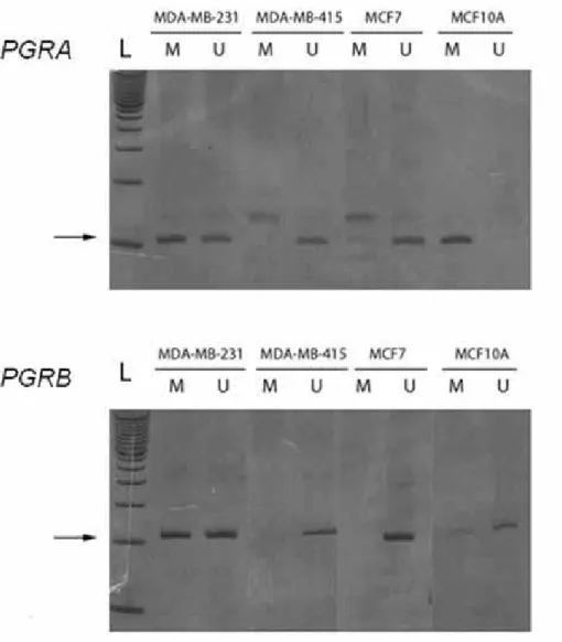 Figura 5.  Análise de MSP do gene PGR em amostras de DNA utilizadas para a padronização das  reações de amplificação indicando a especificidade do produto para o ensaio do promotor B (PGRB)