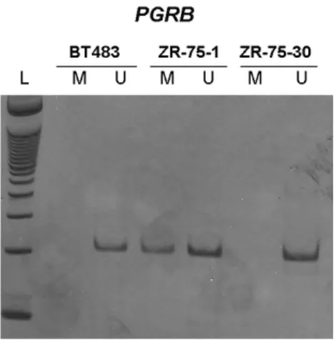 Figura  10  –  Eletroforese  em  gel  de  poliacrilamida  ilustrativo  do  padrão  de  metilação  do  promotor  B  do  gene  PGR  nas  linhagens  BT483,  ZR-75-1  e  ZR-75-30