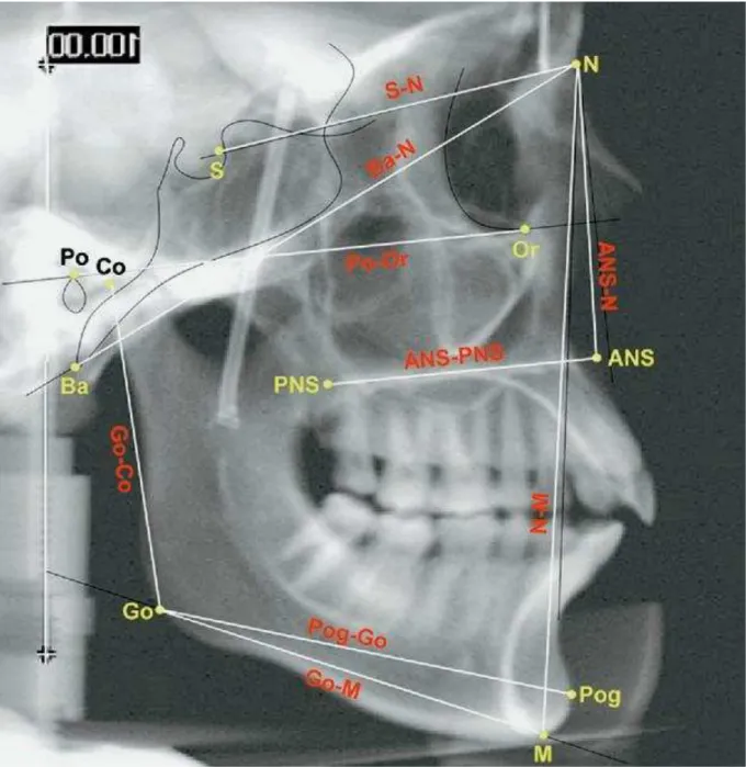 FIGURA  11  –  Pontos e planos  cefalométricos  marcados na  imagem 2D  representativa  de  uma  radiografia  cefalométrica  gerada  de  um  crânio  seco