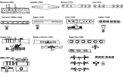 Figura 11 – Evolução das placas de fixação interna nestes 100 anos adaptado de Uhthoff et al