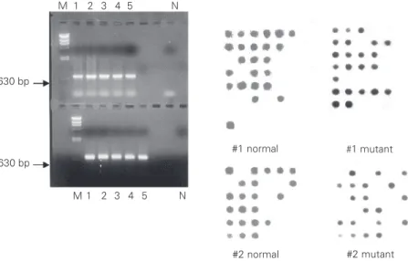 Figure 1. Gamma-globin gene amplification and dot-blot analyses of CAR ß S -haplotype.