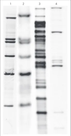 Figure 2. Number of isolates ac- ac-cording to the number of IS1245 bands observed. Clustered strains are outlined and  repre-sent one strain per patient.