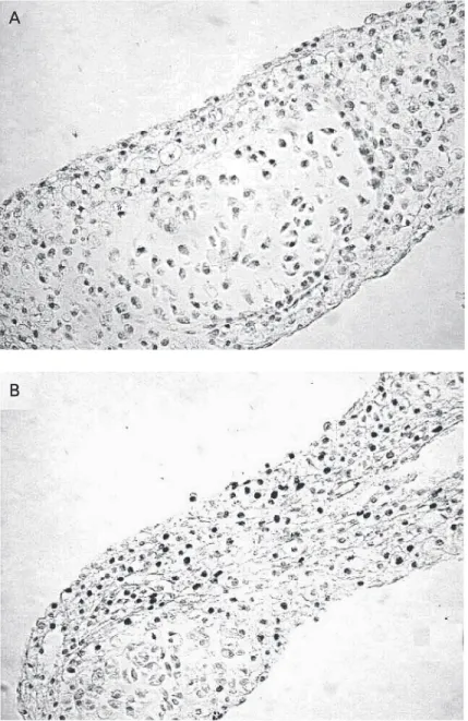Figure 2. Analysis of cell proliferation of chick limb mesenchyme. In later stages (day 21), when cell  matu-ration prevails over cell prolifematu-ration, the number of proliferating cells positively stained for proliferating cell nuclear antigen (PCNA) gr