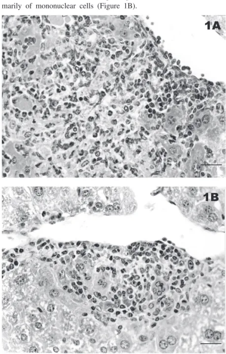 Figure 1. Histologic sections from the liver of germ-free mice infected with Helicobacter trogontum