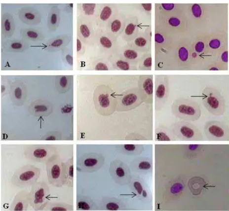 Figura 3: Micronúcleos e alterações nucleares em eritrócitos  de Oreochromis niloticus, após exposição a amostras de águas  coletadas ao longo do rio Preto