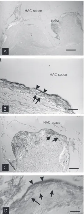 Figure 4. A, Bone formation on the surface of a hydroxyapatite ceramic (HAC)/skeletal stem cell construct which was  trans-planted into the subcutaneous tissue of an  immunocompro-mised mouse