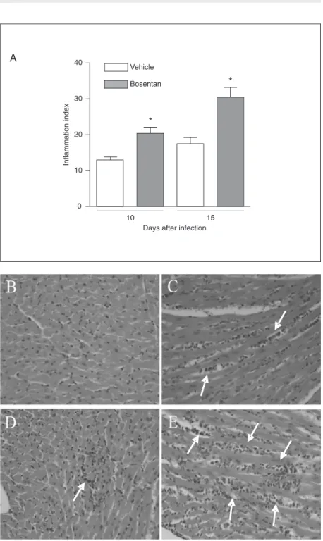 Figure 2. Effect of oral treatment with bosentan on the inflammation in the myocardium of Trypanosoma cruzi-infected mice