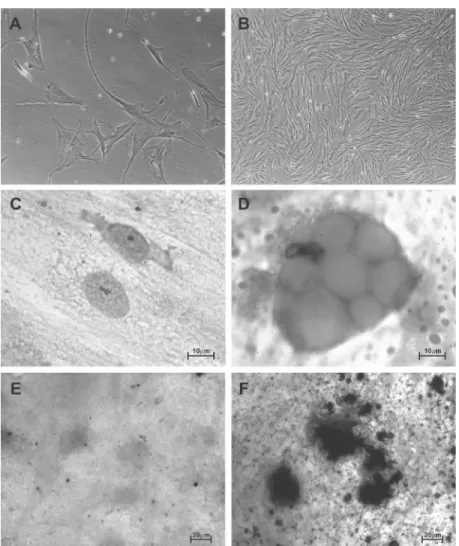 Figure 1. Morphology of bone marrow-mesenchymal stem cells (BM-MSCs) in culture, BM- BM-MSCs without differentiation induction and after differentiation into adipocyte and osteocyte from an untreated chronic myeloid leukemia (CML) patient