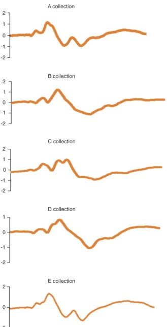 Table  2.  Intra-group  comparison  of  the  average  latencies  of  the  V  wave  of  the  auditory  brainstem  response at the different times of collection.