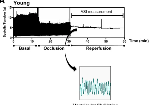 Figure 1. Original raw traces of contraction force (tension, g) of representative experiments conducted  on  (A)  young  and  (B)  middle-aged  rats