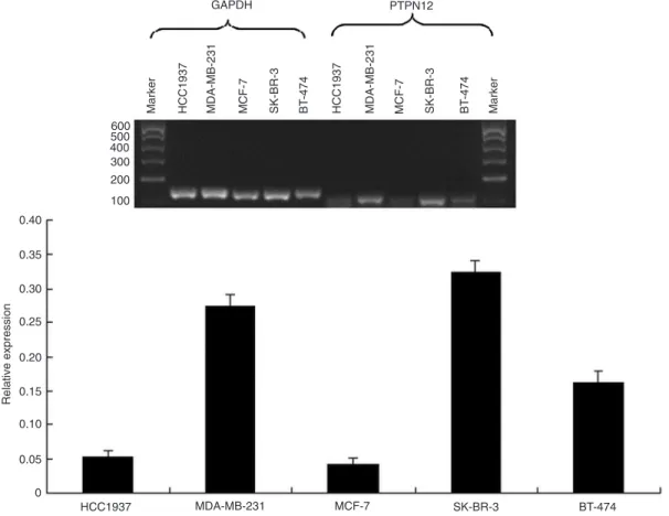 Figure 1). PTPN12 protein immunohistochemistry (Figure  2)  demonstrated  that  PTPN12  protein  expression  was  down-regulated (negative and weak expression) in 32.0% 