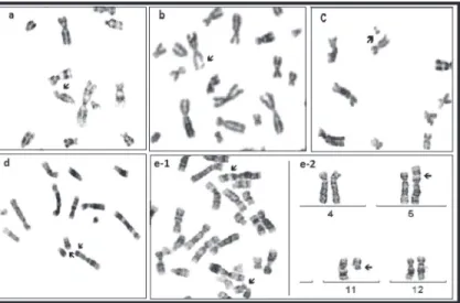 Figure  1.  Representative  chromosome  aberrations  (arrows)  in  metaphase  spreads