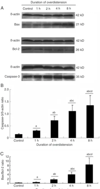 Figure 5. Effect of different durations of overdistention (DOD) on  the expression of apoptosis-related proteins: A, Western blotting  analysis of Bax, Bcl-2 and caspase-3, and β-actin as control