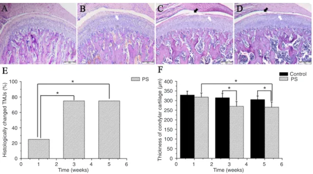 Figure 3. Representative H&amp;E staining of condylar cartilages in control rats ( A ), 1-week PS rats ( B ), 3-week PS rats ( C),  and 5-week PS rats ( D )