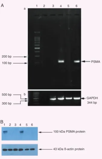 Figure 1. PSMA mRNA transcripts by RT-PCR and PSMA/β-actin  expression  by  Western  blot