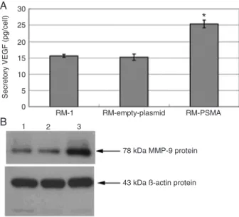 Figure 2.  Expression  of  VEGF,  MMP-9,  and  β-actin  protein  in  cell lines. A, Quantification of VEGF protein by ELISA; *P < 0.01  for RM-PSMA cells compared to RM-1 cells and negative control  cells (one-way ANOVA)