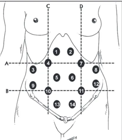 Figure 1. Location of the 14 points studied. Planes A = subcostal; B = transtuber- transtuber-cular; C = right hemiclavitranstuber-cular; D = left hemiclavicular