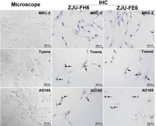 Figure 4. Immunohistochemical (IHC) staining of human cytomegalovirus (HCMV)-infected MRC-5 cells using  mAbs ZJU-FH6 and ZJU-FE6