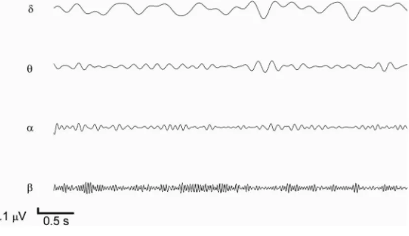 Figure 3 shows the cortical rhythms ﬁ ltered from ECoG segments using a FT ﬁlter for the control group