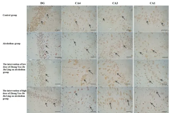 Table 1. Number of brain-derived neurotrophic factor (BDNF)-positive neurons in the dentate gyrus and hippocampus (CA4, CA3, and CA1) in the four groups.