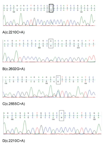 Figure 2. SETBP1 mutations (boxed) present in the son (A-C) and the father (D). Upper rows indicate normal sequences, and lower rows indicate patient sequences.