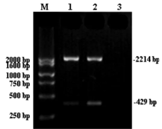 Figure 1. RT-PCR ampli ﬁ cation using cDNA templates from two acute leukemia (AL) patients revealed an expected 2214-bp band and an unexpected 429-bp band representing differential splicing.