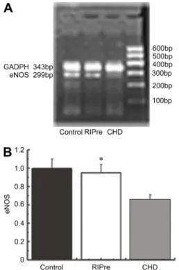 Table 3. Number of endothelial progenitor cells (CD34 + ), white cells and flow-mediated dilation (FMD) in remote ischemic preconditioning (RIPre) and coronary heart disease (CHD) patients and the control group.