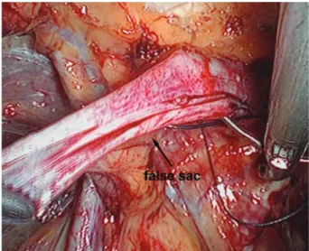 Figure 9. Upper and lower edges of the defect were sutured together.