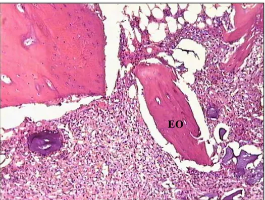 Figura 13: Tetraciclina 7 dias. Cavidade experimental preenchida por coágulo sangüíneo (CS) e fragmentos ósseos ( EO)