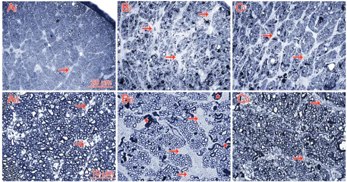 Figure 1. Semithin cross sections of rat optic nerves. Ai and Aii, Normal optic nerve having several bundles of nerve ﬁ bers among septa within astrocytic processes (arrows)