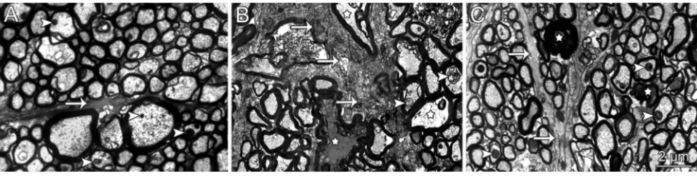 Figure 3. A, Quanti ﬁ cation of optic nerve mye- mye-linated ﬁ bers. Data are reported as means ± SD.