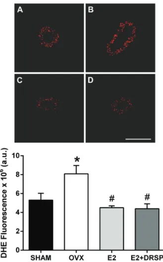 Figure 4. Analysis of oxidative stress in coronary arteries from ovariectomized spontaneously hypertensive rats by  dihydroethid-ium ﬂ uorescence (DHE)
