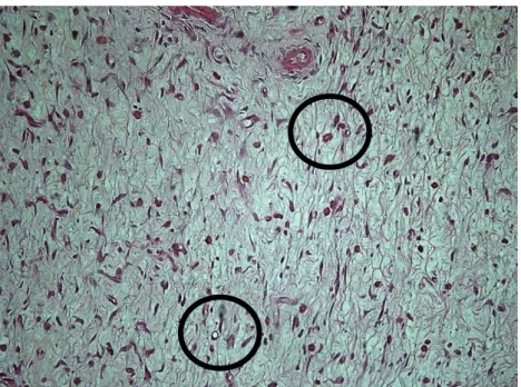 Figura 20 -  Fotomicrografia de corte histológico da borda  cutânea  de  rato,  corado  com  hematoxilina  e  eosina,  analisado com microscopia óptica no aumento de 200X e  classificado  como  Angiogênese  do  tipo  Leve,  com  a  presença de poucos vasos