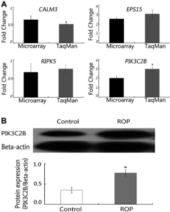 Figure 4. Validation of microarray data in HeLa cells. A, CALM3, EPS15, RIPK5, and PIK3C2B underwent TaqMan s real-time PCR in HeLa cells