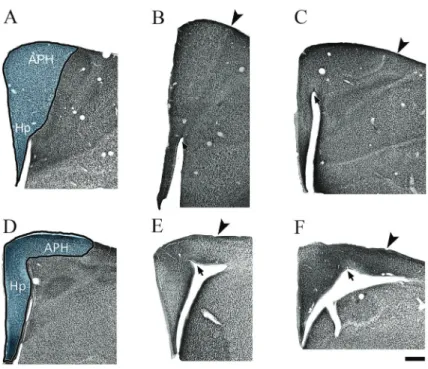 Figure 4 shows a series of photomicrographs taken from different focus planes of Iba1-immunolabeled  sec-tions to illustrate hippocampal microglia morphology in shorebirds (C