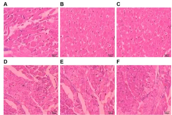 Figure 2. Hematoxylin-eosin staining of myocardial tissue in the sham operation (S) group (A), ischemia-reperfusion (I/R) group (B), normal saline (NS) group (C), fentanyl (Fen)1 group (2 mg/kg) (D), Fen2 group (4 mg/kg) (E), and Fen3 group (6 mg/kg) (F).