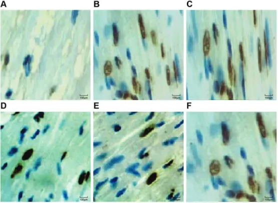 Figure 5. TUNEL staining detecting myocardial cells in the sham operation (S) group (A), ischemia-reperfusion (I/R) group (B), normal saline (NS) group (C), fentanyl (Fen)1 group (2 mg/kg) (D), Fen2 group (4 mg/kg) (E), and Fen3 group (6 mg/kg) (F)