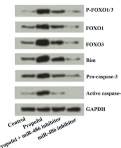 Figure 4. Western blot results for cell viability and apoptosis in H1299 cells, showing that the expressions of all evaluated proteins were signi ﬁ cantly elevated by propofol, but these effects were reversed by transfection with miR-486 inhibitor in H1299